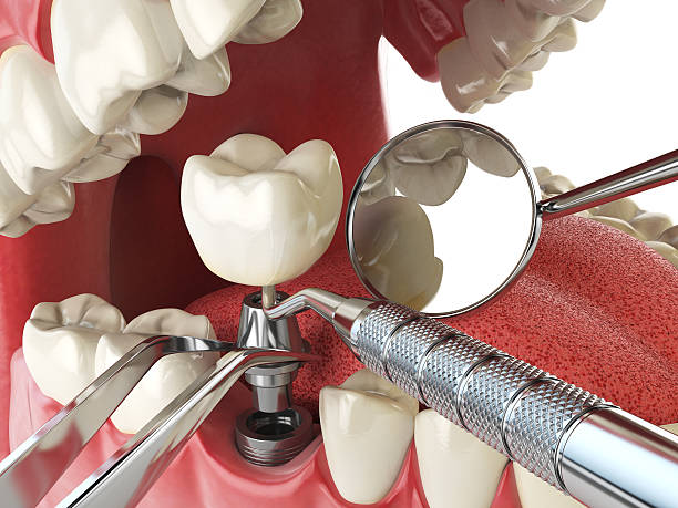 Best Urgent Tooth Repair  in Tawas City, MI